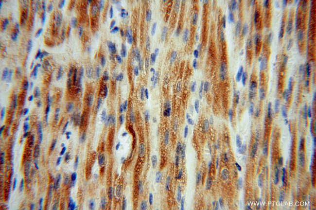 CISD1 Antibody in Immunohistochemistry (Paraffin) (IHC (P))