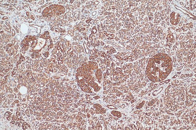 CISD1 Antibody in Immunohistochemistry (Paraffin) (IHC (P))