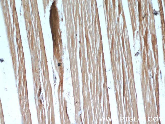 PLA2G12A Antibody in Immunohistochemistry (Paraffin) (IHC (P))