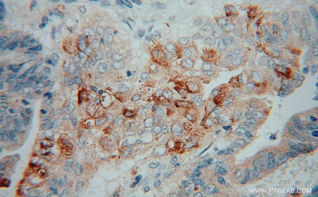 PLA2G12A Antibody in Immunohistochemistry (Paraffin) (IHC (P))