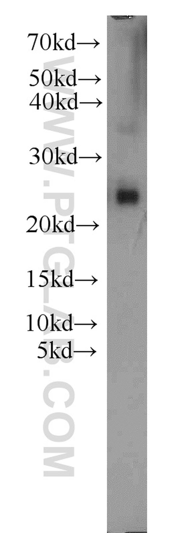 PLA2G12A Antibody in Western Blot (WB)