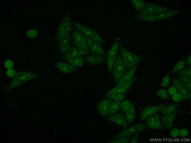 LAS1L Antibody in Immunocytochemistry (ICC/IF)