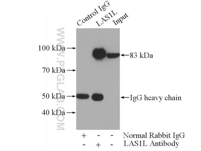 LAS1L Antibody in Immunoprecipitation (IP)