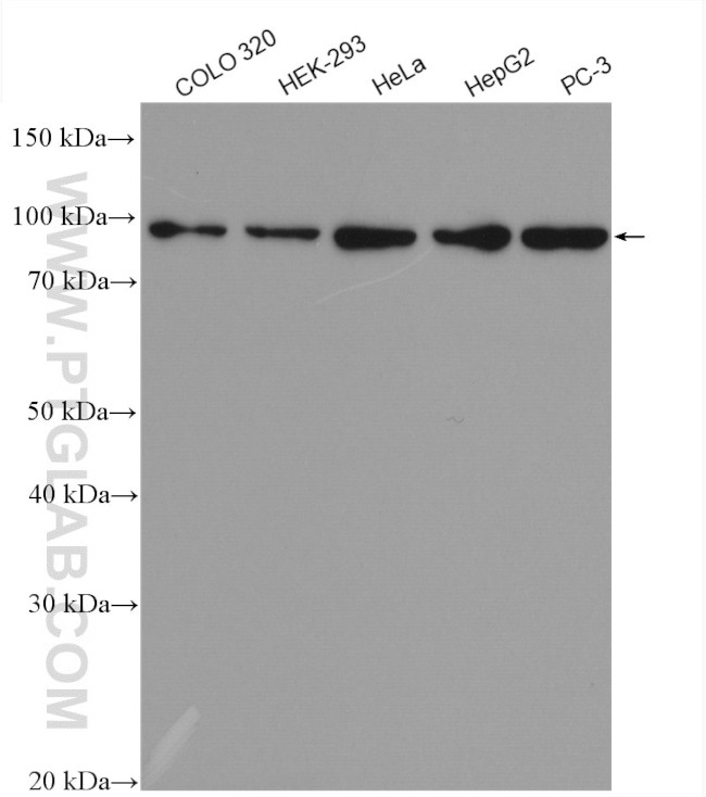 LAS1L Antibody in Western Blot (WB)