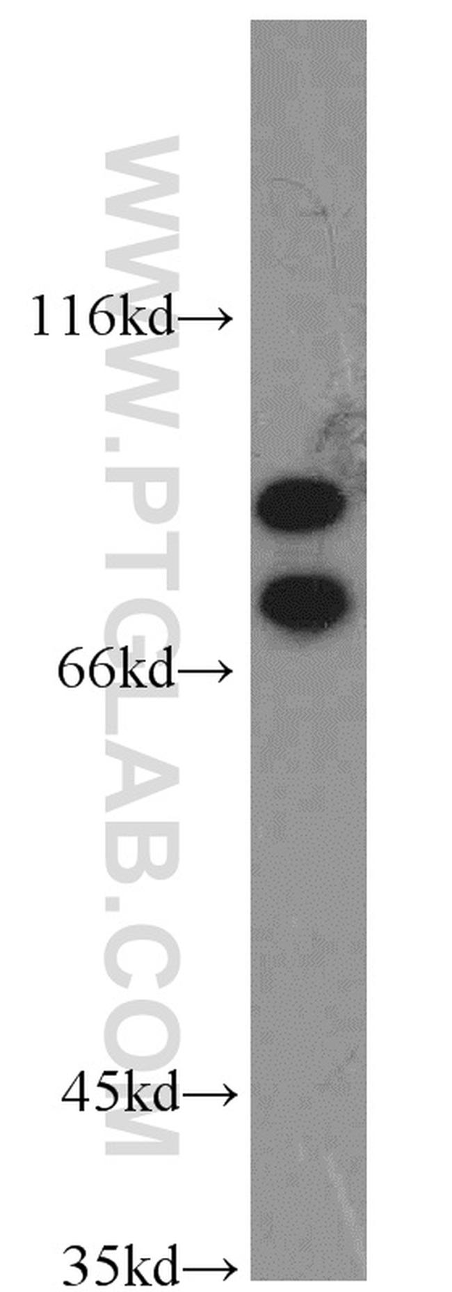 LAS1L Antibody in Western Blot (WB)