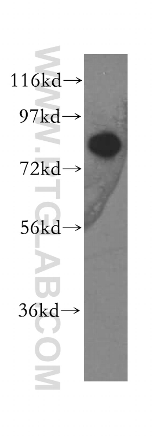 LAS1L Antibody in Western Blot (WB)