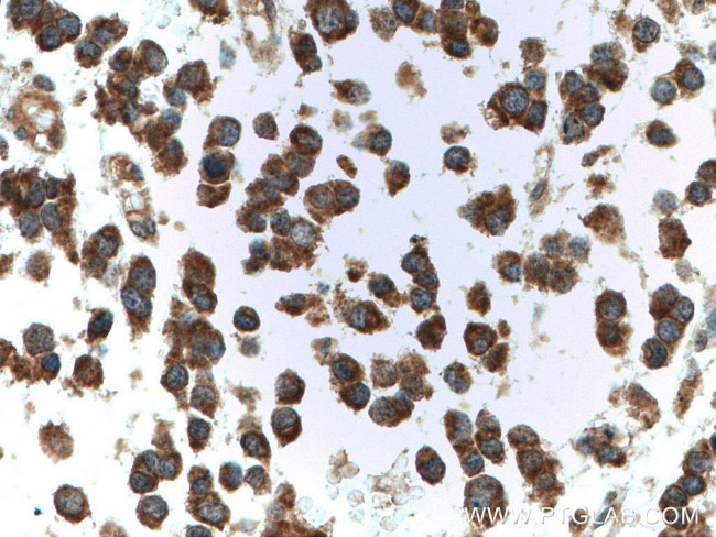 CYFIP1/2 Antibody in Immunohistochemistry (Paraffin) (IHC (P))