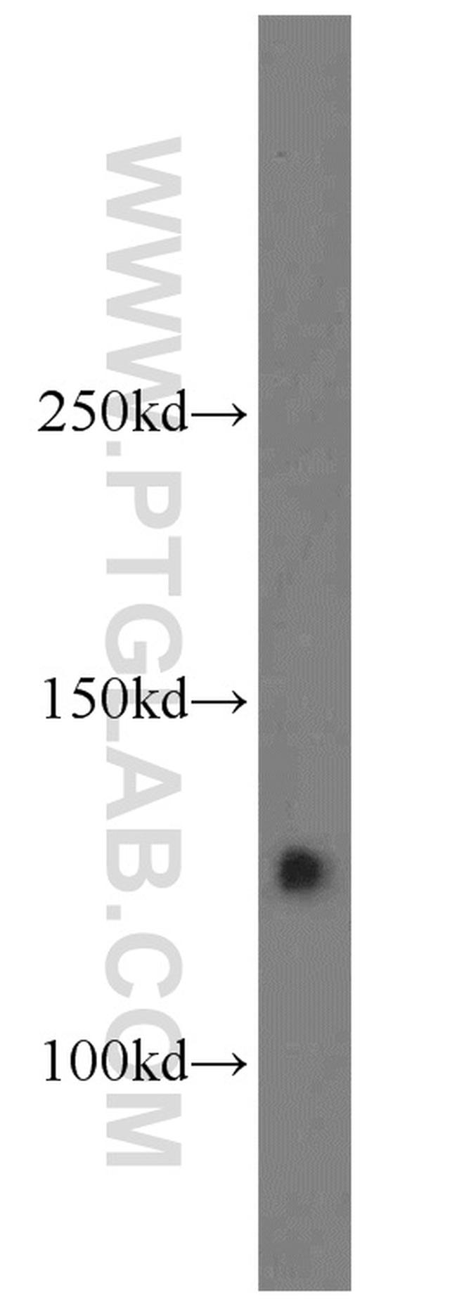 CYFIP1/2 Antibody in Western Blot (WB)