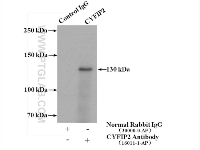 CYFIP1/2 Antibody in Immunoprecipitation (IP)