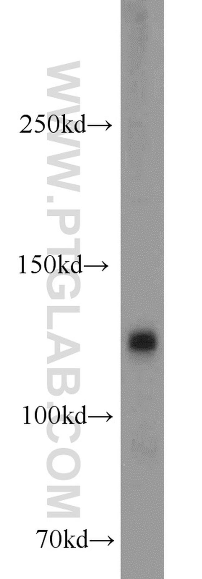 CYFIP1/2 Antibody in Western Blot (WB)