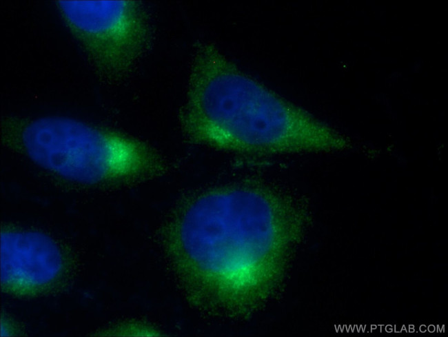 ARL1 Antibody in Immunocytochemistry (ICC/IF)