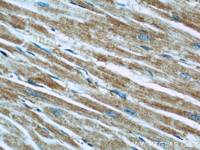 TRAPPC9 Antibody in Immunohistochemistry (Paraffin) (IHC (P))