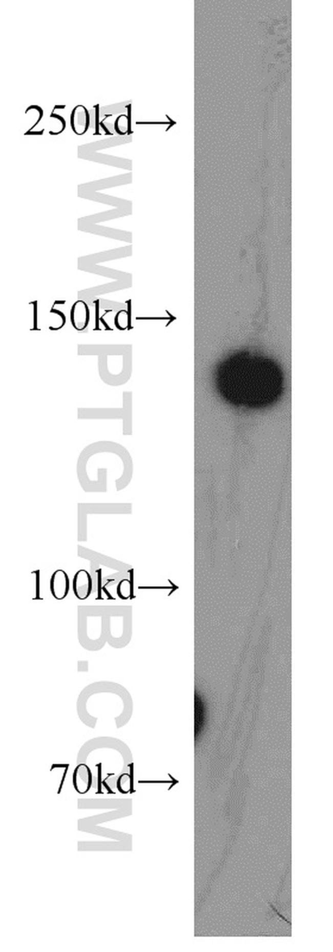 TRAPPC9 Antibody in Western Blot (WB)