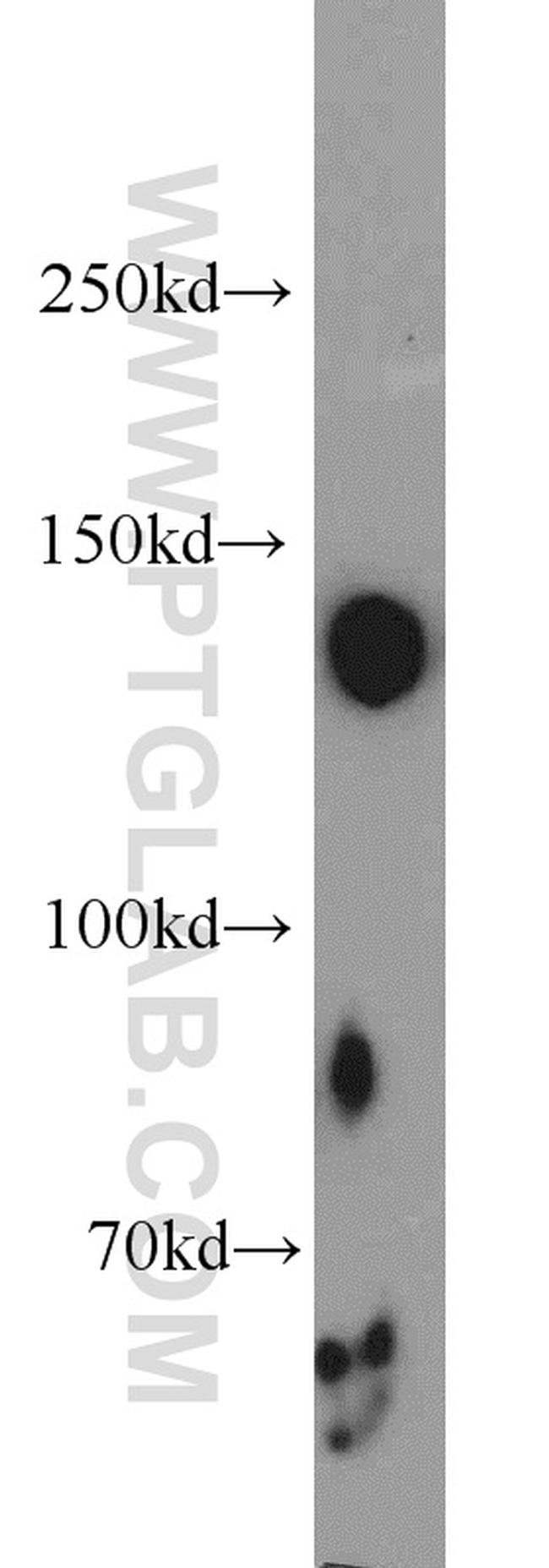 TRAPPC9 Antibody in Western Blot (WB)