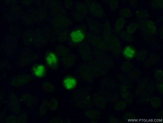 MMS19 Antibody in Immunocytochemistry (ICC/IF)