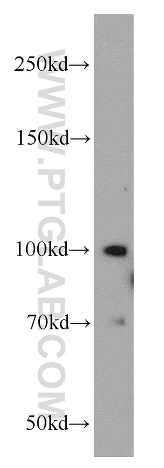 MMS19 Antibody in Western Blot (WB)