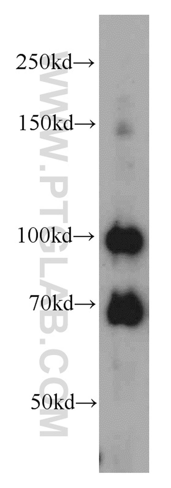 MMS19 Antibody in Western Blot (WB)