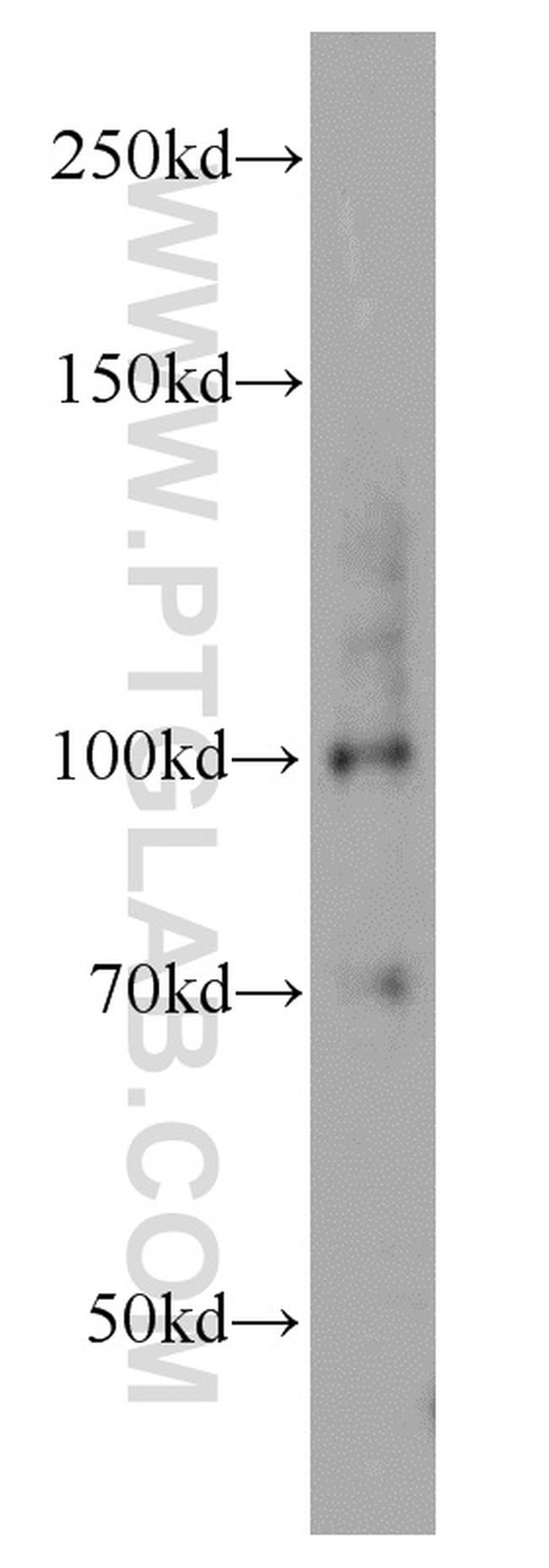 MMS19 Antibody in Western Blot (WB)