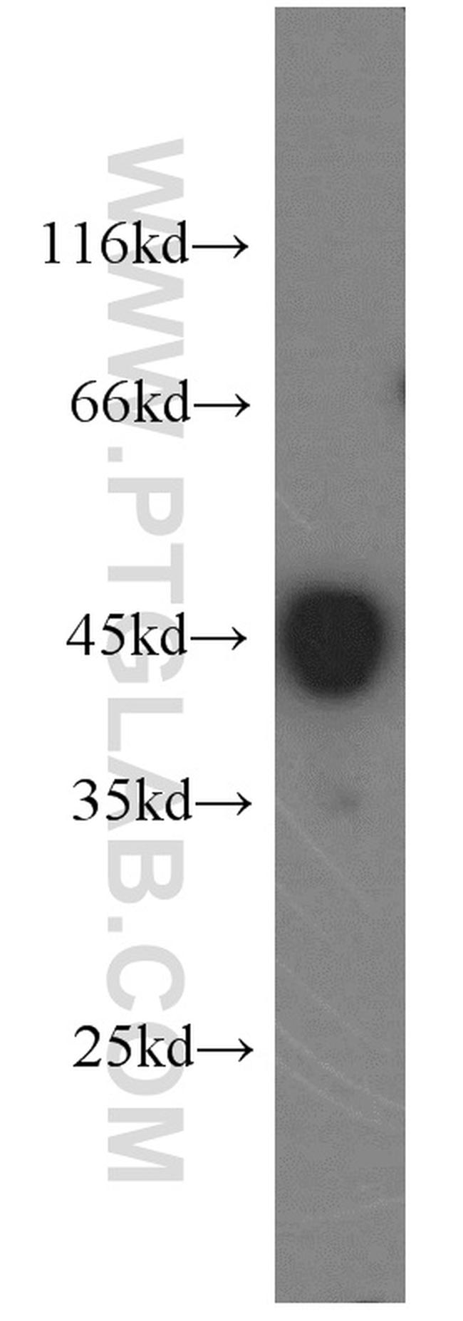 ILKAP Antibody in Western Blot (WB)