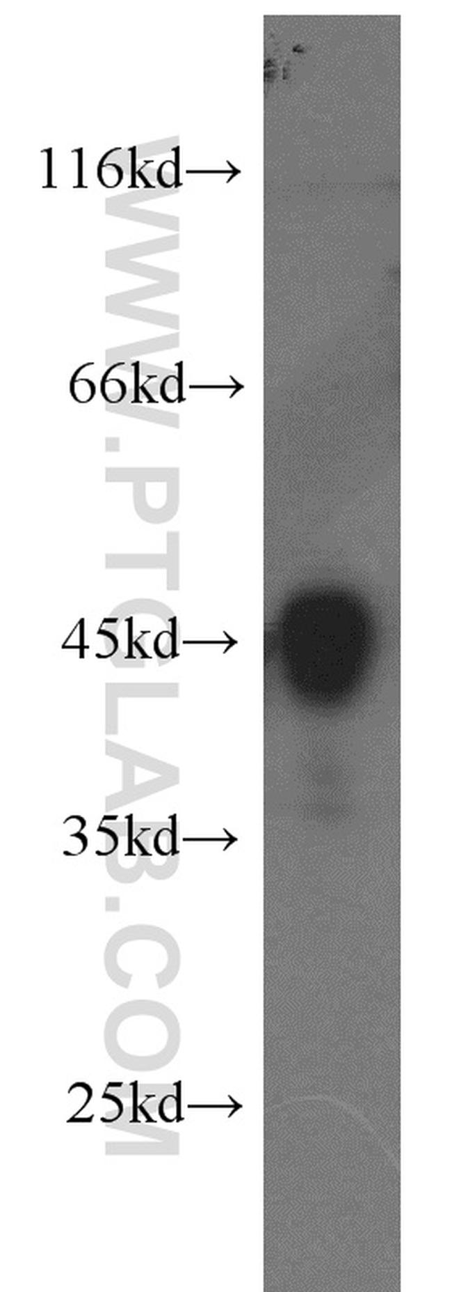 ILKAP Antibody in Western Blot (WB)