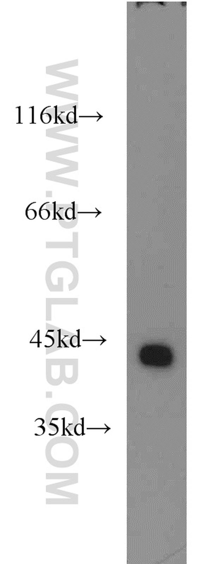 ILKAP Antibody in Western Blot (WB)