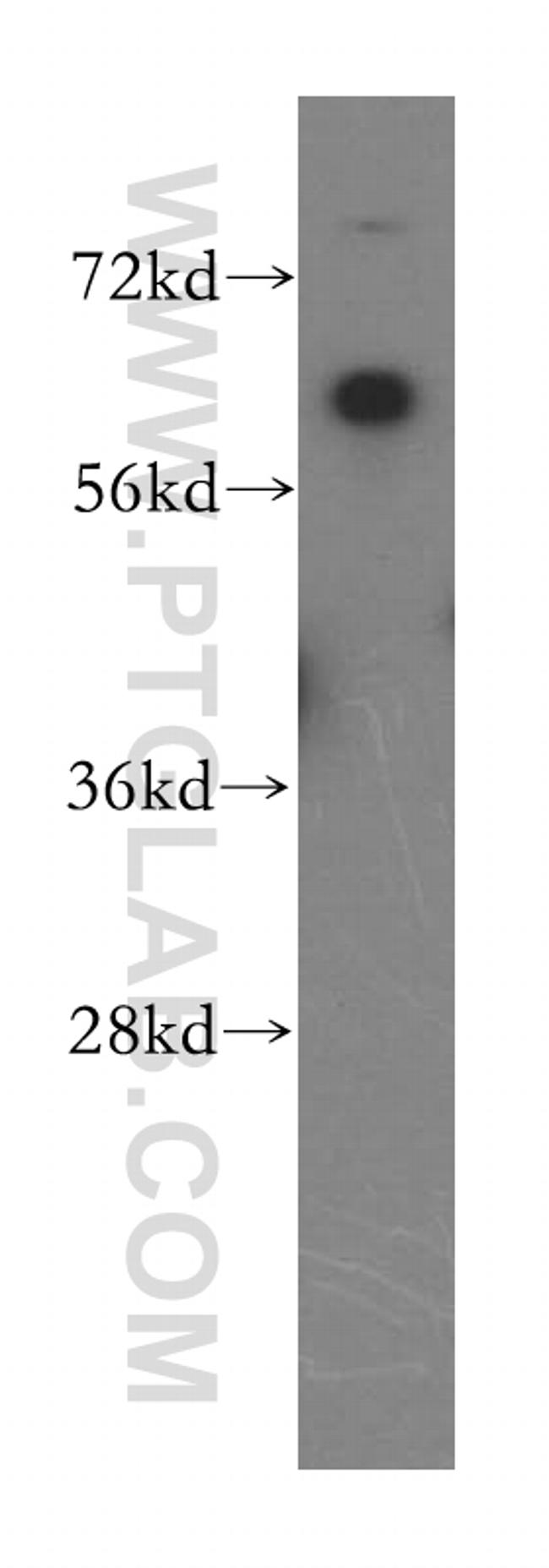 DBR1 Antibody in Western Blot (WB)