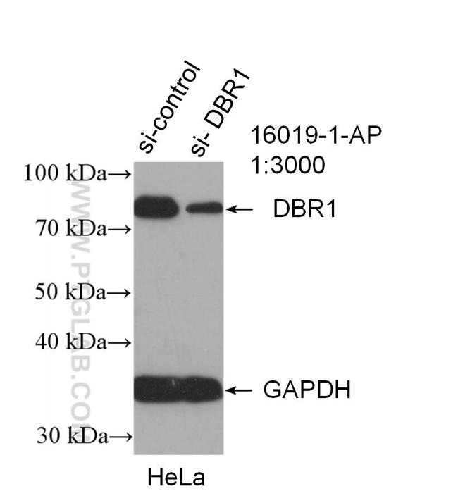 DBR1 Antibody in Western Blot (WB)