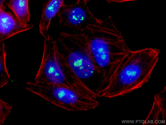 FBL Antibody in Immunocytochemistry (ICC/IF)