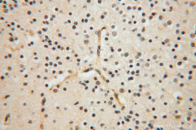 GALM Antibody in Immunohistochemistry (Paraffin) (IHC (P))