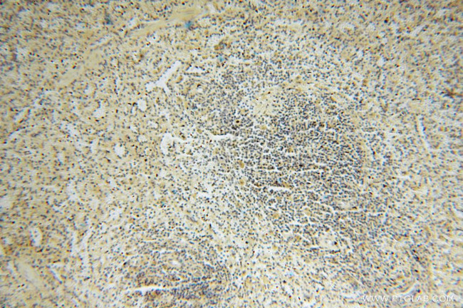 GALM Antibody in Immunohistochemistry (Paraffin) (IHC (P))