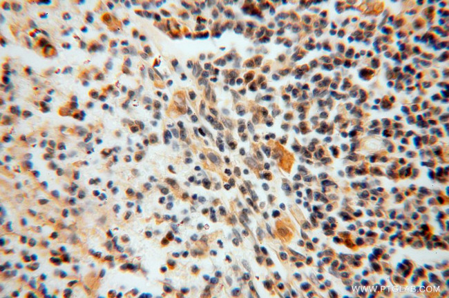 GALM Antibody in Immunohistochemistry (Paraffin) (IHC (P))