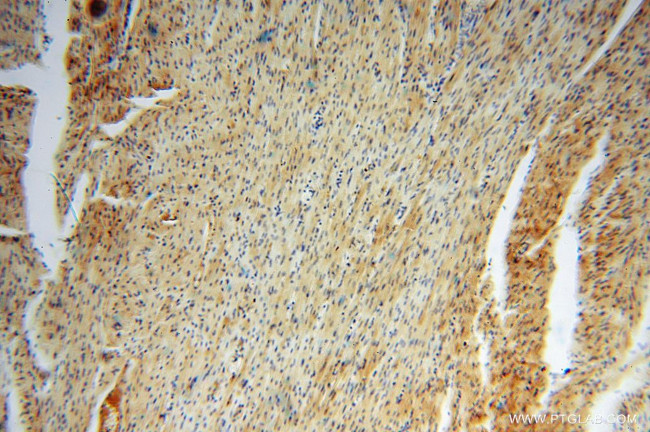 GALM Antibody in Immunohistochemistry (Paraffin) (IHC (P))