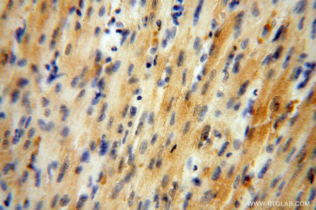 GALM Antibody in Immunohistochemistry (Paraffin) (IHC (P))