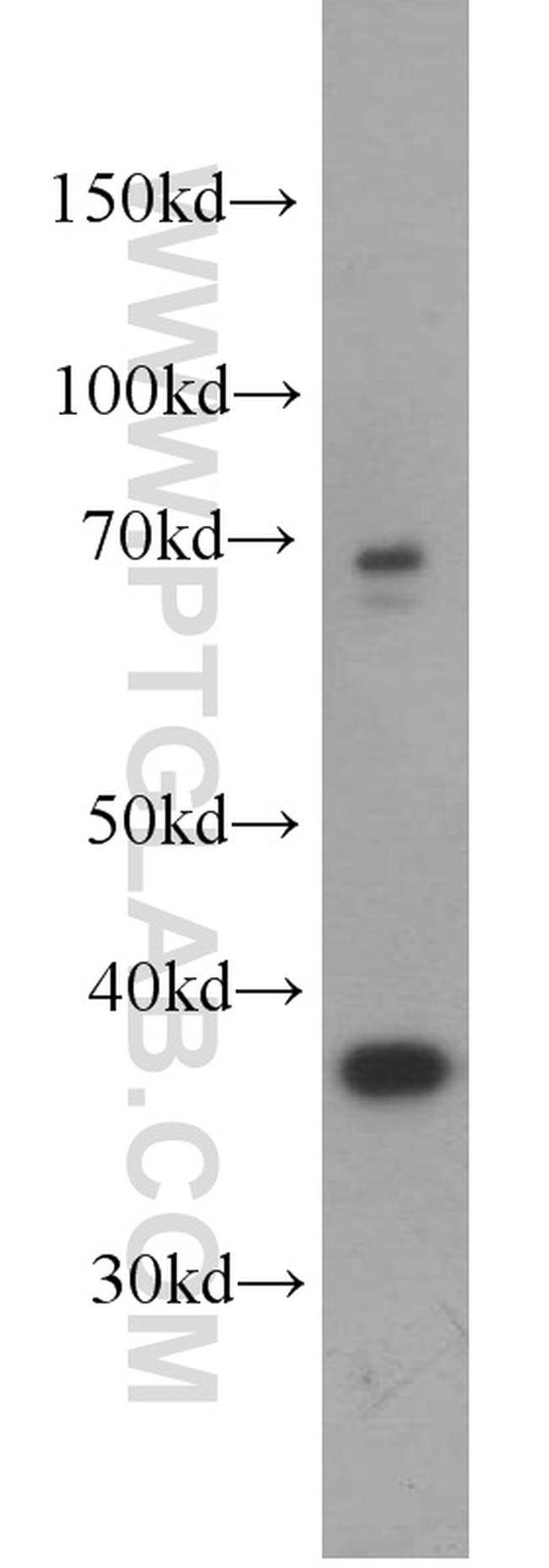 GALM Antibody in Western Blot (WB)