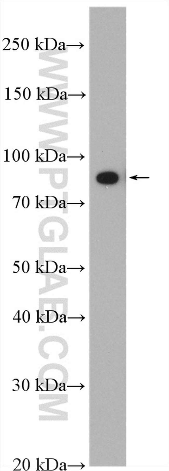 P3H3 Antibody in Western Blot (WB)