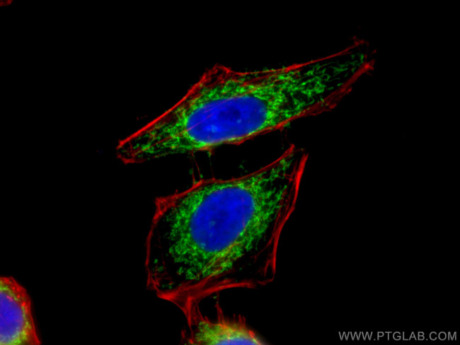 LETM1 Antibody in Immunocytochemistry (ICC/IF)