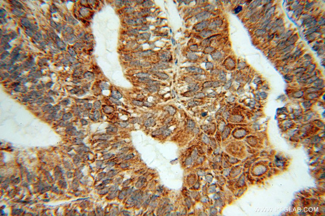 LETM1 Antibody in Immunohistochemistry (Paraffin) (IHC (P))