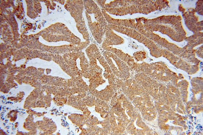 LETM1 Antibody in Immunohistochemistry (Paraffin) (IHC (P))