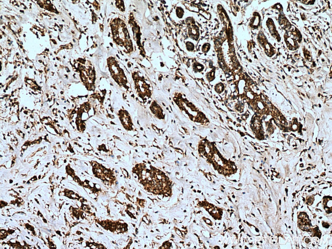 LETM1 Antibody in Immunohistochemistry (Paraffin) (IHC (P))