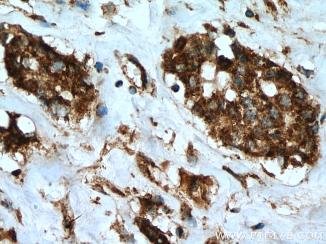 LETM1 Antibody in Immunohistochemistry (Paraffin) (IHC (P))