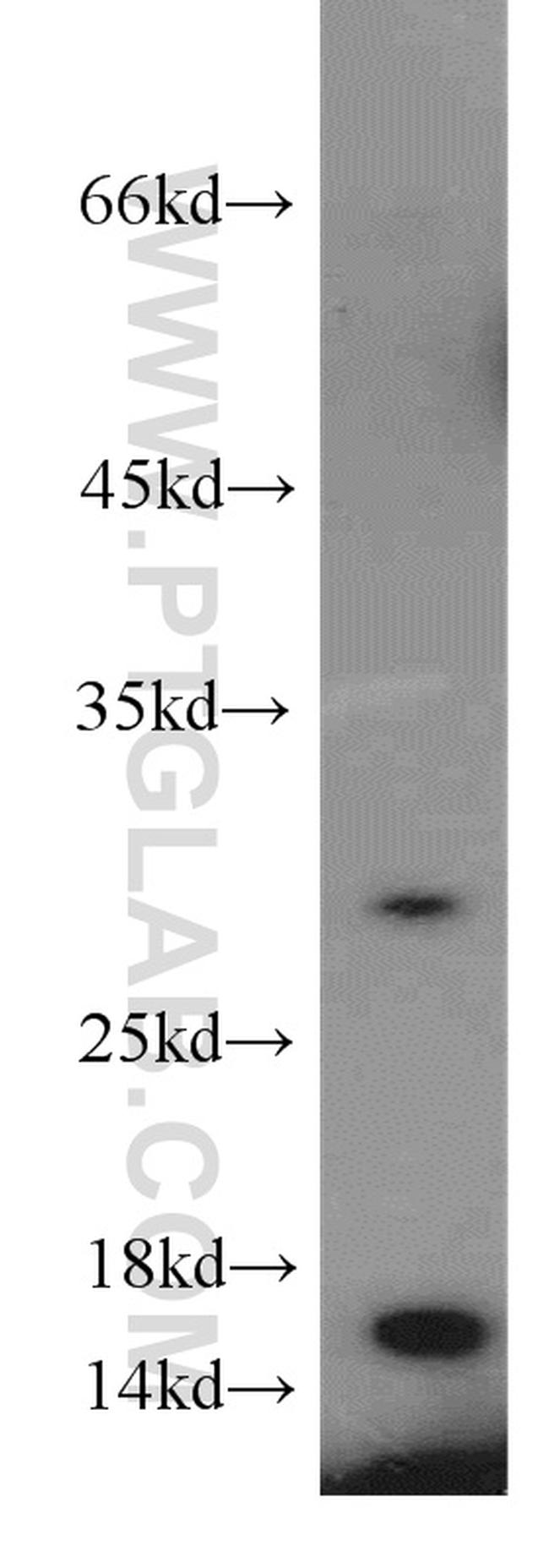 CST1 Antibody in Western Blot (WB)