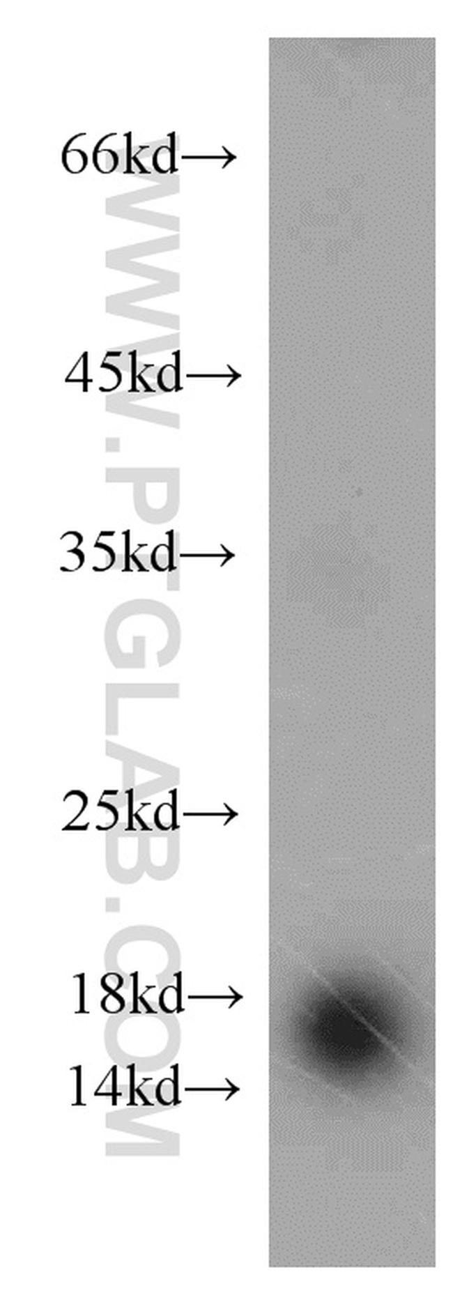 CST1 Antibody in Western Blot (WB)