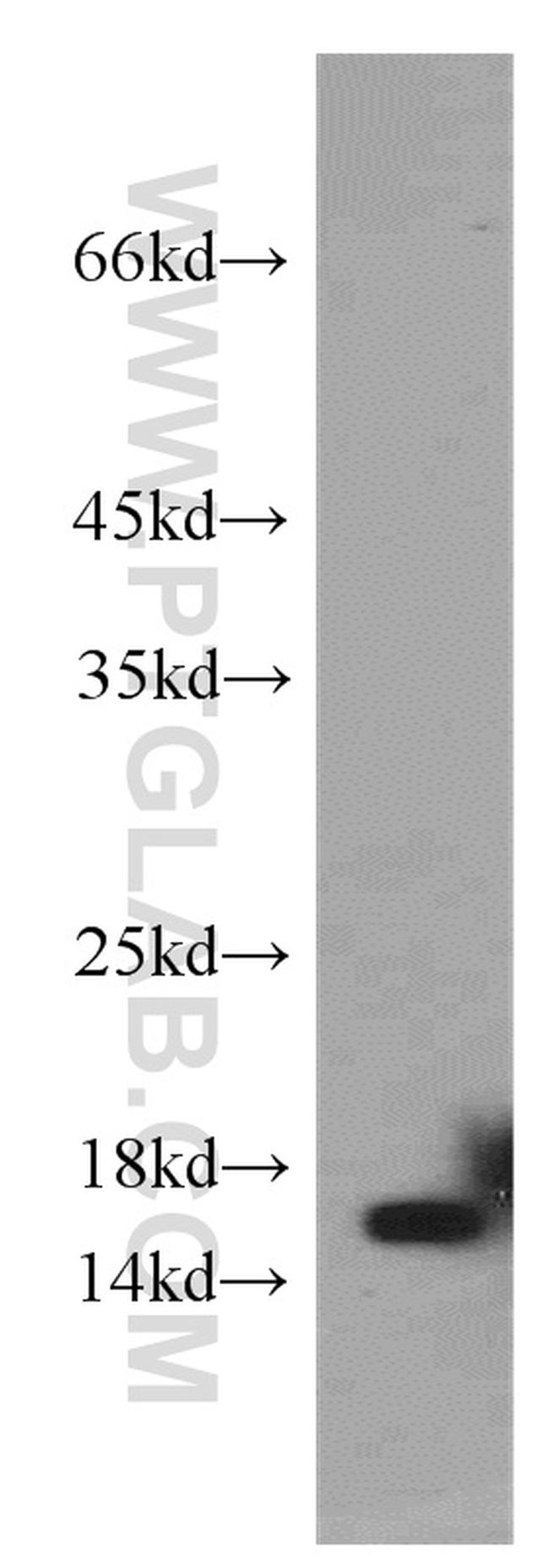 CST1 Antibody in Western Blot (WB)