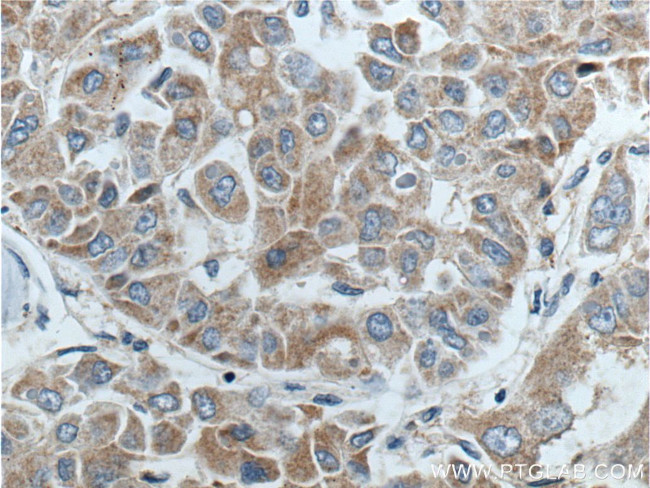 BCL2L2 Antibody in Immunohistochemistry (Paraffin) (IHC (P))