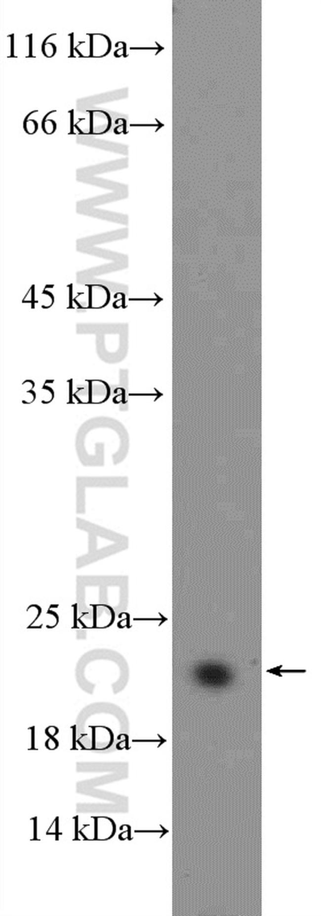 BCL2L2 Antibody in Western Blot (WB)