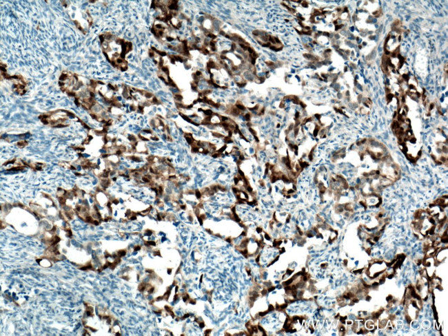 S100A1 Antibody in Immunohistochemistry (Paraffin) (IHC (P))