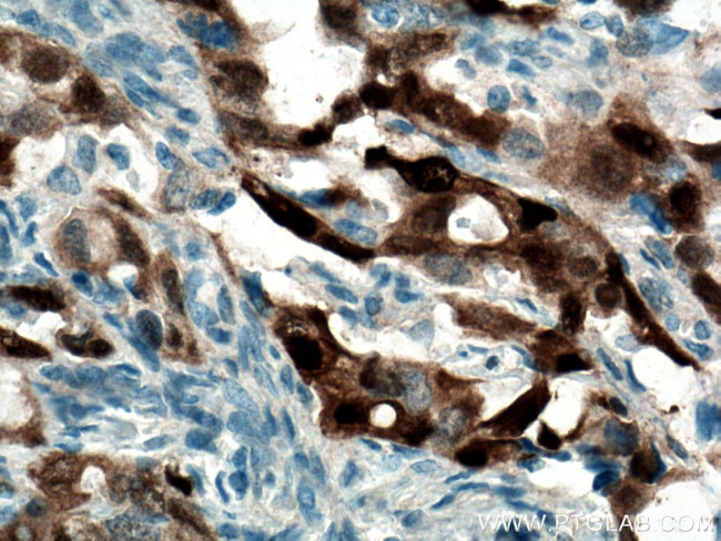 S100A1 Antibody in Immunohistochemistry (Paraffin) (IHC (P))