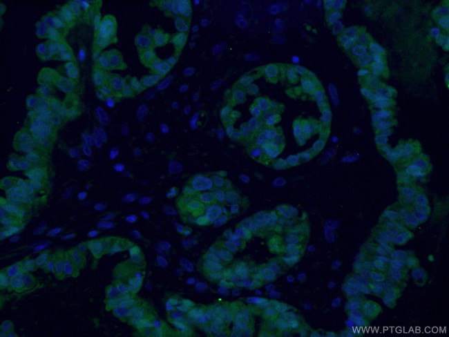 S100A1 Antibody in Immunocytochemistry (ICC/IF)