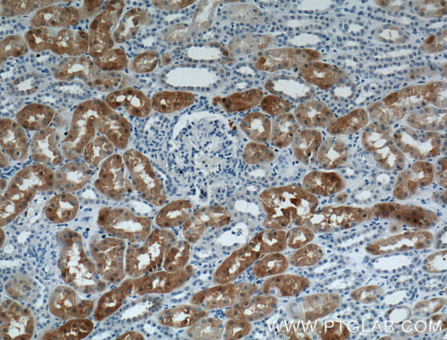 S100A1 Antibody in Immunohistochemistry (Paraffin) (IHC (P))