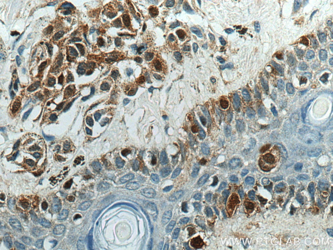 S100A1 Antibody in Immunohistochemistry (Paraffin) (IHC (P))